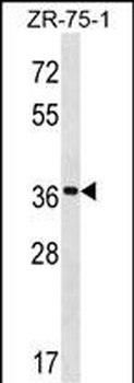 FUT7 Antibody (N-term)