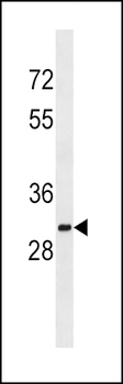 SULT1A2 Antibody (C-term)