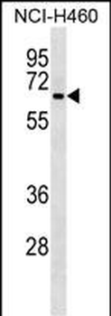 DCT Antibody (Center)