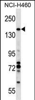 VCIP1 Antibody (N-term)