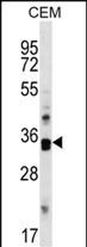 Mouse Cdk10 Antibody (C-term)