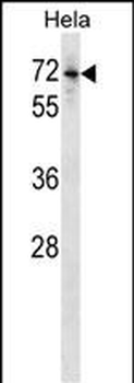 Mouse Bmpr1b Antibody (Center)