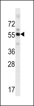 ZBTB8B Antibody (C-term)