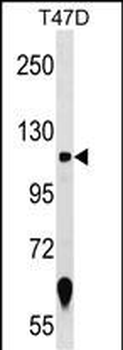 ZNF217 Antibody (N-term)