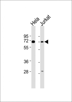 CBFA2T2 Antibody (N-term)