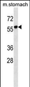 RUNDC1 Antibody (C-term)