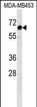 STEAP3 Antibody (C-term)