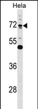 EPN1 Antibody (Center)