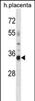 OR4K13 Antibody (N-term)