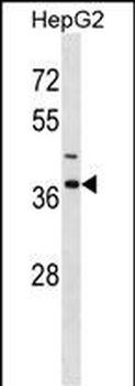 IGBP1 Antibody (Center)