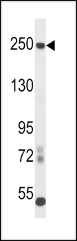 L1CAM Antibody (C-term)