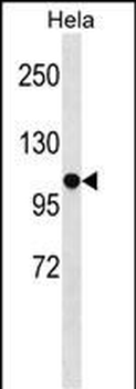 SFRS8 Antibody (N-term)