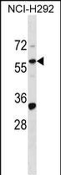 ZNF136 Antibody (N-term)