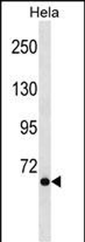 NCOA4 Antibody (C-term)