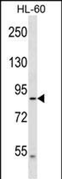 DNAH2 Antibody (N-term)