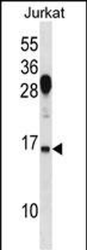 RHOG Antibody (C-term)