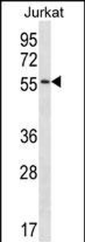 C1RL Antibody (Center)