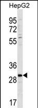 ZDHC3 Antibody (N-term)