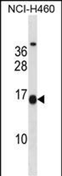 MSGN1 Antibody (Center)