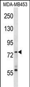 Mouse Syk Antibody (Center)