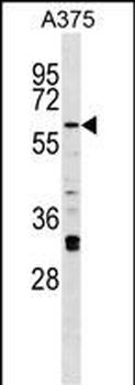 Mouse Irak2 Antibody (C-term)