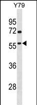 TAF1A Antibody (N-term)