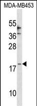 CCL25 Antibody (Center)