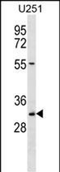 TCEA2 Antibody (Center)