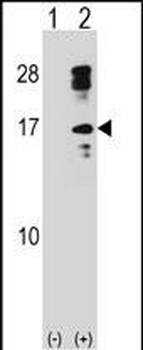 CLC Antibody (C-term)