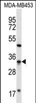 FTSJ1 Antibody (N-term)