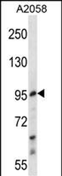 E2F7 Antibody (Center)