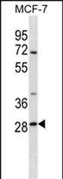 SRPRB Antibody (C-term)