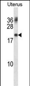 PMP22 Antibody