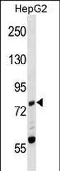 Mouse Zap70 Antibody (C-term)