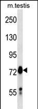 Mouse Mark4 Antibody (C-term)