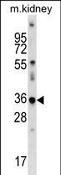 Mouse Cdkl4 Antibody (C-term)
