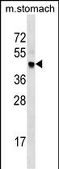 Mouse Cdk20 Antibody (Center)