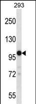 TRPM4 Antibody (C-term)