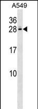 C4BPB Antibody (Center)