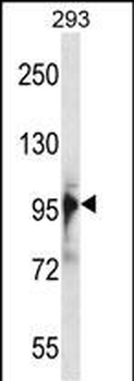 RBM10 Antibody (N-term)