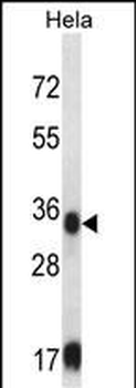 SORD Antibody (Center)