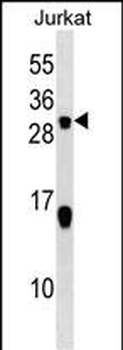 STMN2 Antibody (C-term)