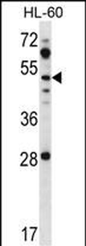 ZIC1 Antibody (N-term)