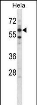 Mouse Adck5 Antibody (N-term)