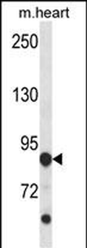 Mouse Cdkl5 Antibody (C-term)