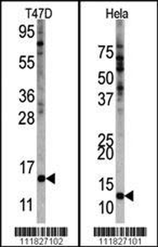 FAU Antibody (Center)