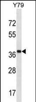 CLIP4 Antibody (Center)