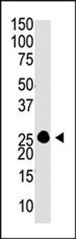 GCAP1 Antibody (C-term)