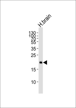 Hippocalcin Antibody (N-term)