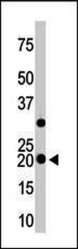 VILIP3 Antibody (N-term)